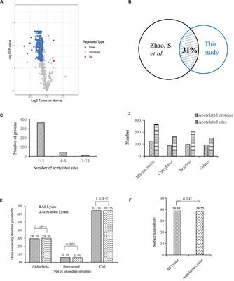 Lysine Acetylome Study of Human Hepatocellular Carcinoma Tissues for Biomarkers and Therapeutic Targets Discovery